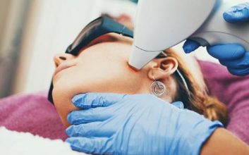 What Are The Amazing Benefits Of Laser Hair Removal Treatment?