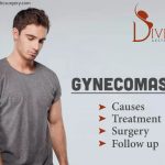 Gynecomastia