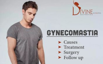 Gynecomastia