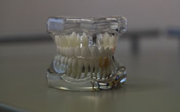 Dental cavitation