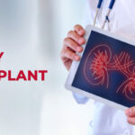 Kidney Transplant